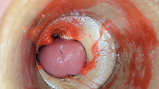 Camera Inside Deep Pussy Captures Big dose Ejaculation of Sperm ASMR