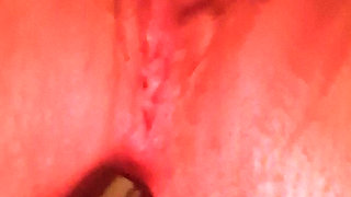 Analplug