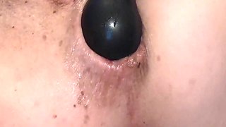 Anal Gaping and Prolapse Compilation!