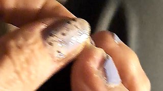 Peeling a Huge Toe Skin Flake