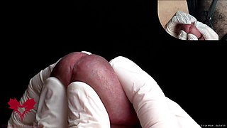 Glans Game with White Latex Gloves in Super-closeup