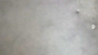 Margot Pees with a Big Bruise on Her Leg