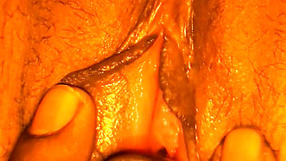 Sister-in-law's rash itching mitigated