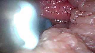 Visual Guide to G-spot Stimulation and Orgasm - Endoscopic Perspective