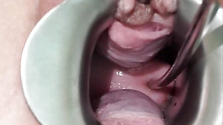 Milf Julie plays with her cervix