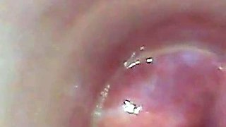 Endoscope POV: Test Tube Cock Urethral Insertion