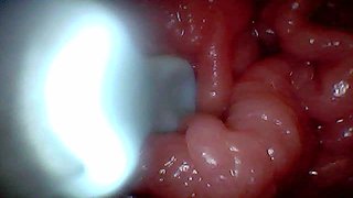 First Time: an Endoscope Reveals the G-spot up Close - Without Mounting!