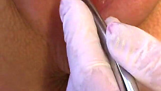 German BDSM doctor games