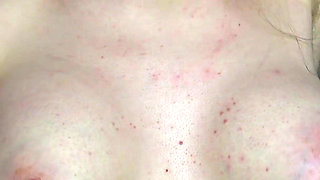 Revealing My Boobs After Breast Reconstruction (3-week Progress Update)