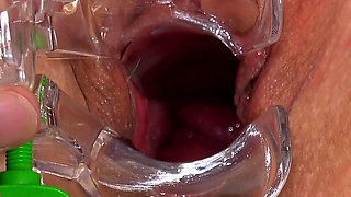 Mature Pussy of Sexy Granny Miya Examined