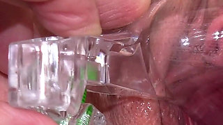Big Clit Pussy Examined with Speculum