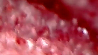 Medical Endoscope Oral Exam: Gummy Chewing, Extreme Teeth & Tongue Macro