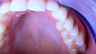 Teeth Fetish Extreme Close-up Dental Examination