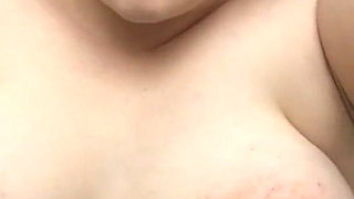 Bruised beautiful agony