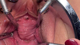 Sklavin S Fucks Her Piss Hole and Cervix at the Same Time