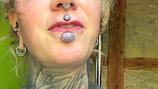 Day 3 After My Boobs and Upper Blephoplasty Op