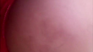 My Butt Cheek Got Purple From a Spanking