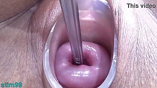 Chinese Extraordinary Cervix Shagging