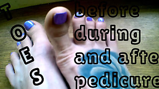 Lady Angela Hand Held Toesbefore a Pedicure